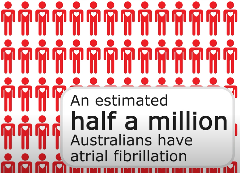 You’re in Rhythm but is your heart? Learn about Atrial Fibrillation